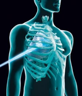 Petal : Un hyper-laser. Uniquement pacifique, on vous dit …